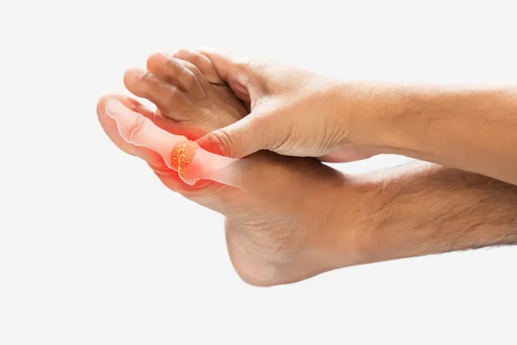 Swelling in the joint of the big toe